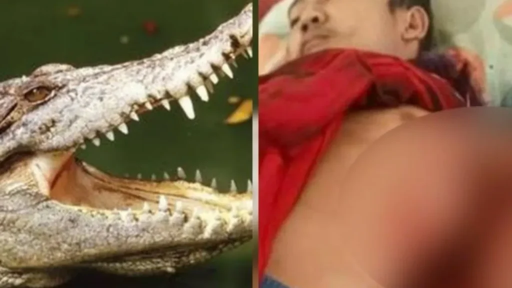 Buaya Serang Warga Sungai Dusun Cahaya! Korban Alami Patah Tulang dan Luka Serius